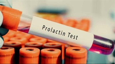 أسباب زيادة هرمون الحليب وأعراضه ومخاطره وطرق العلاج 