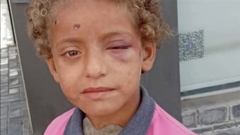 الطفلة كارما الشهيرة