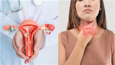  متلازمة تكيس المبايض، 6 نصائح فعالة لموازنة الهرمونات بشكل طبيعي