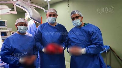 مستشفى التأمين الصحي ببني سويف ينجح في استئصال ورم سرطاني ضخم لمُسن 
