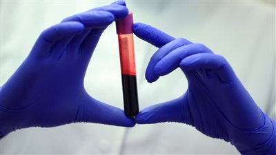 يحمله 50 شخصا فقط حول العالم، محاولة لاستنساخ 