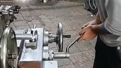 طبيب يكشف تفاصيل إنقاذ يد عامل خراطة بعد بترها في لحظة داخل ورشة