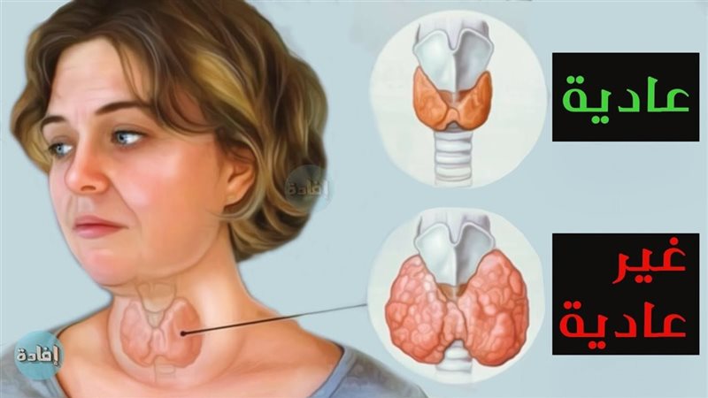 أعراض قصور الغدة