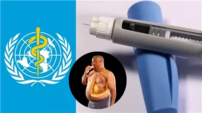 بعد اعتماد الصحة العالمية لأدوية علاج السمنة، ما أهمية القرار للمرضى؟