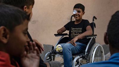 صحة غزة في اليوم العالمي للإعاقة: 6 آلاف حالة بتر تحتاج إلى برامج تأهيل