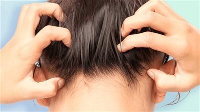 نصائح تحمي شعرك من القشرة في الشتاء 