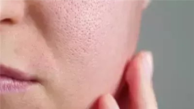 نصائح مهمة تجنبك ظهور المسام الواسعة بالبشرة