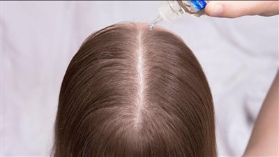 طرق العناية بفروة الرأس في الشتاء بالمواد الطبيعية