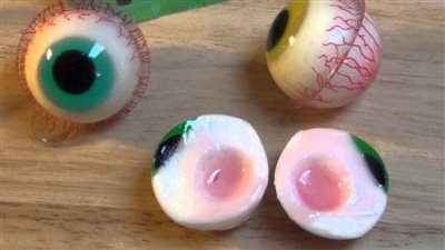 استشاري يحذر من تقديم حلوى جيلي العيون للأطفال 