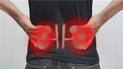 أعراض وأسباب التهاب الكلى، عدوى خطرة تستدعي العلاج الفوري