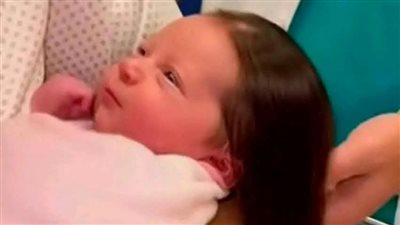 بعد جدل واسع، هل يمكن ولادة أطفال بشعر طويل جدا؟ استشارى تجيب