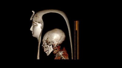 زاهى حواس يكشف أسرار مومياء الملك أمنحتب الأول بالأشعة المقطعية | صور