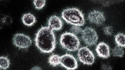 ارتفعت بنسبة 30%.. الصحة التركية تعلن عدد الإصابات اليومية بكوفيد-19