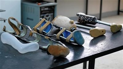 بعد توطين صناعة الأطراف الصناعية.. الأجهزة المناسبة لأنواع الإعاقات الحركية