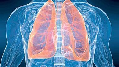 أسباب وأعراض التليف الرئوى وطرق العلاج 