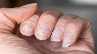 وصفات طبيعية لتقوية الأظافر وإطالتها 