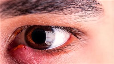 6 طرق بسيطة للتخلص من 