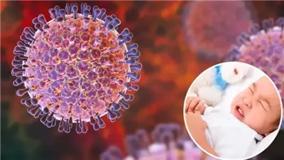 أسباب إصابة الأطفال بفيروس الروتا وطرق الوقاية