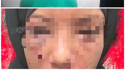 تأجيل محاكمة المتهم بالتعدي على طفلة ومحاولة فقأ عينيها بالشرقية إلى الأربعاء 