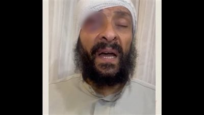 ابنه سرق شقا عمره وتركه على الحديدة، حكاية صادمة لطبيب أصيب بنزيف في المخ بالشرقية