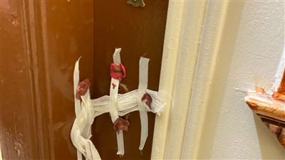 صحة سوهاج: ضبط طالبة انتحلت صفة طبيبة جلدية في ساقلتة