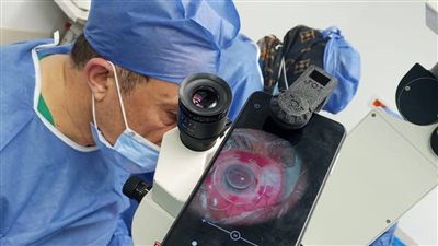 نجاح زرع قرنية معقدة وإنقاذ الإبصار لسيدة تحت مظلة التأمين الصحي بالأقصر
