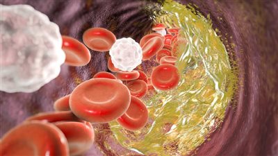 غذاء بسيط قد يحدث فرقا في صحة القلب وخفض الكوليسترول