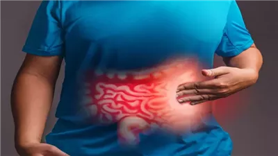 وصفة طبيعية لعلاج التهاب القولون والغازات