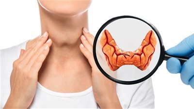 أكلات ممنوعة على مرضى خمول الغدة الدرقية 