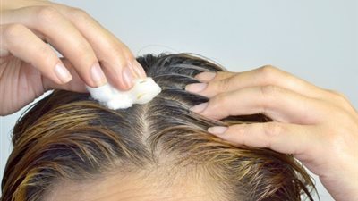 وصفة الخل للقضاء على قشرة الشعر فى الشتاء 