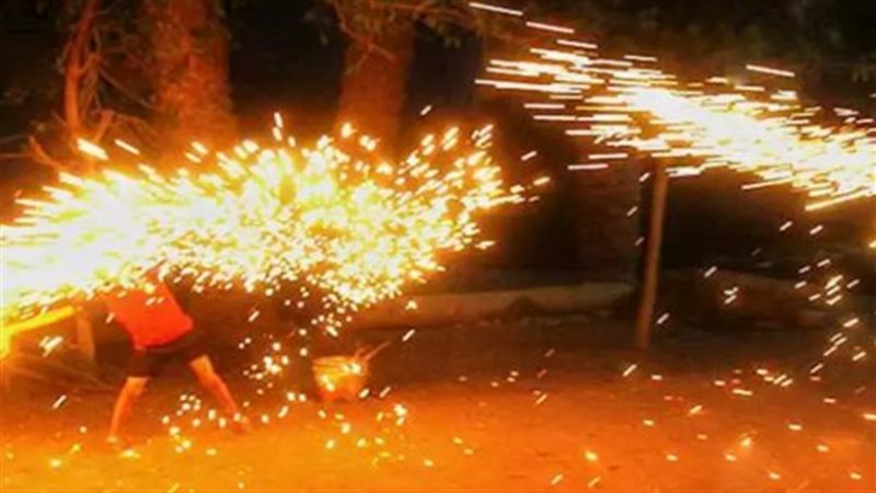 إصابة طفل بحروق بالغة