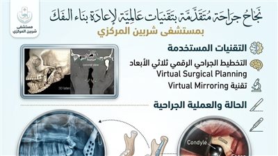  إعادة بناء 