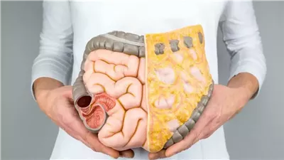  مع نهاية رمضان، خطوات لرفع حرق الدهون بالجسم والتخلص منها