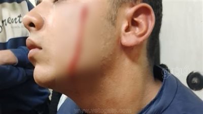 التفاصيل الكاملة لواقعة اعتداء طلاب على زميلهم وتشويه وجهه بالغربية |صور