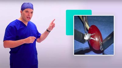 الروبوت الآلي ينجح في إجراء عملية جراحية لـ عنبة