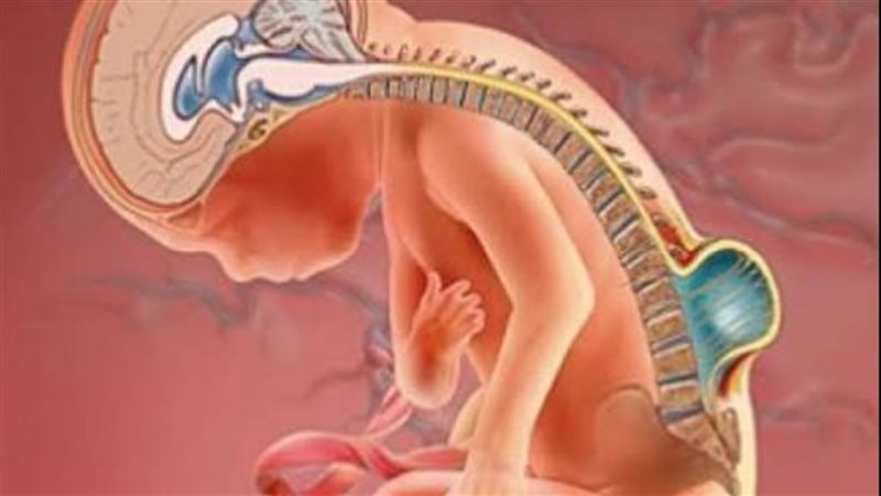 مرض الصلب المشقوق