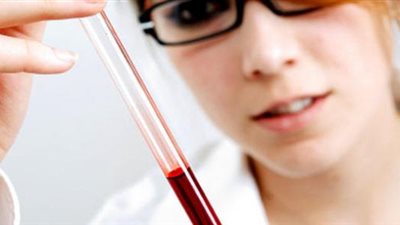 ما هي أعراض ارتفاع الكوليسترول.. اكتشفيها