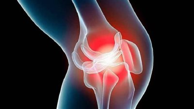  طقطقة العظام، علامة للإصابة بهذا المرض وهذه أسبابها