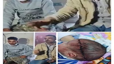 النيابة تحقق في إصابة رضيع بـ 17 غرزة أثناء ولادة قيصرية بالشرقية | صور