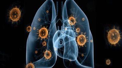 دراسة مفزعة: أوميكرون يكشف العلاقة بين كورونا والسرطان