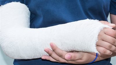 بيزنس أطباء العظام.. مرضى الكسور تحت رحمة سماسرة العمليات الجراحية.. والضحايا في ازدياد