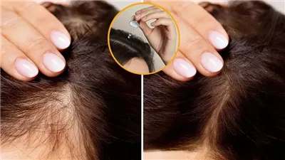 وصفة طبيعية لعلاج فراغات الشعر وزيادة كثافته 