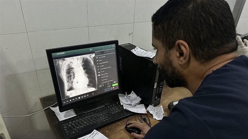  نقص المعدات الطبية