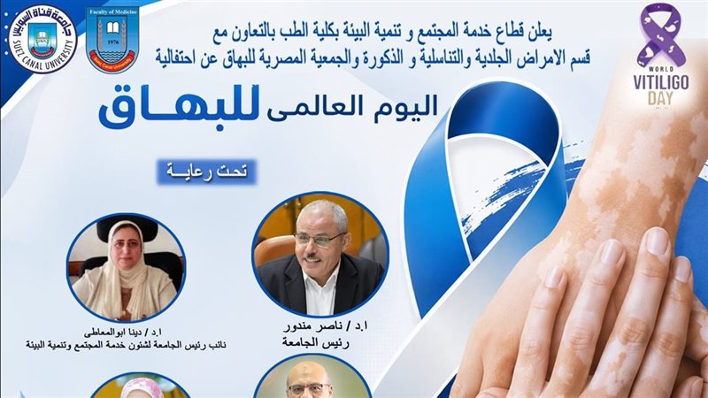 الاحتفال باليوم العالمي