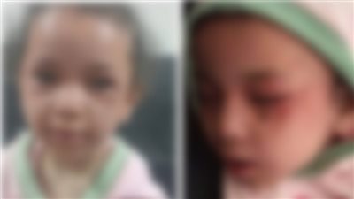 شغلت الأغاني وهي بتقتلها، حكاية الطفلة بسملة التي عادت من الموت بالمنيا