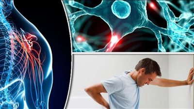 بعد ضربه للجنود الأمريكيين.. دراسة تؤكد: فيروس شائع سبب مرض التصلب المتعدد