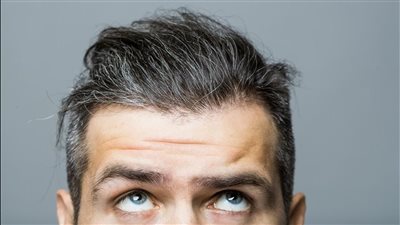 أسباب ظهور الشعر الأبيض مبكرا.. الإجهاد والتوتر أحدها