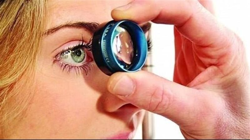 علامات في العينين