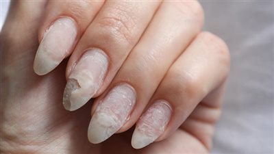 استشارى جلدية تحذر من الباديكير والإيكليرك