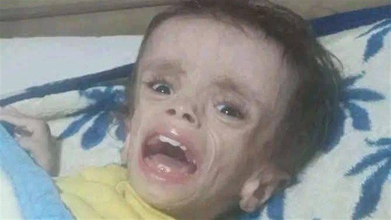 الطفل محمود شادى